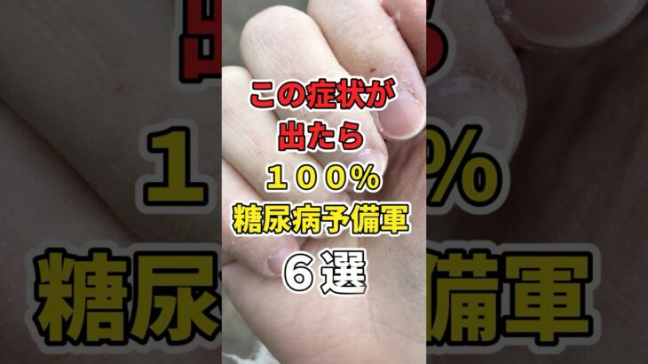 【最悪】”コレ”が見えたら、１００％糖尿病予備軍６選！　#あなたの健康を守るライフハック　 #健康 #雑学  #医療 #糖尿病    #shorts