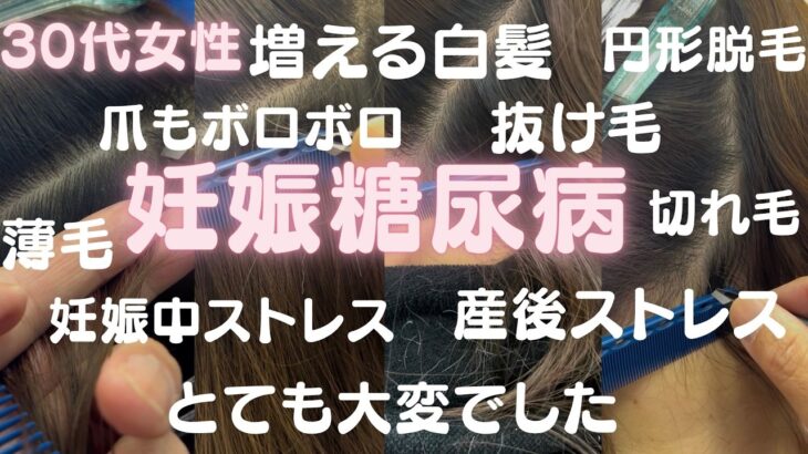 妊娠糖尿病でストレスで白髪も増え、薄毛になり、髪もくせ毛になり、爪もボロボロ、成長しない髪、とてもとても大変だったお話です。今は白髪を抜いてストレス解消！パンドガールで髪も、爪も回復しました。