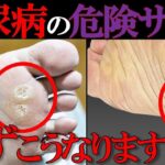 【医師監修】見逃すと危険！糖尿病患者に多い「足に現れる深刻な異変」とは？