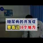糖尿病的并发症，要看这10个地方#糖尿病##周国民#,健康养生,疾病治疗
