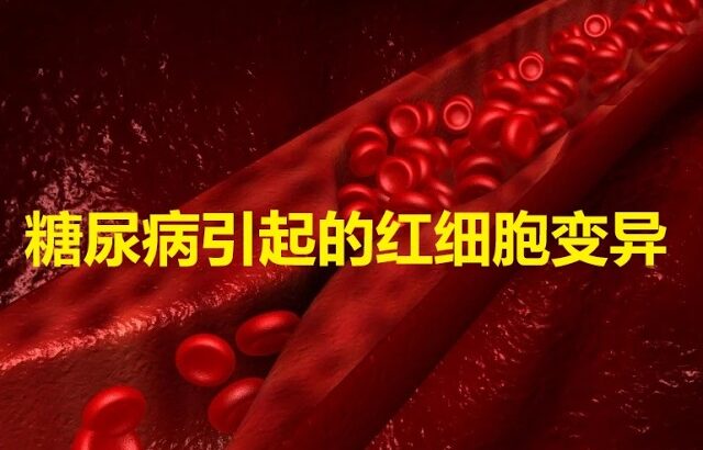 不得不防！糖尿病引发的次生伤害 【科学养生】19