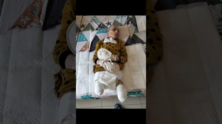 這是2025/4/28 我74歲的媽媽因糖尿病足傷口，經超過半年治療持續惡化，傷口潰爛擴大需要截肢的過程，要把我媽媽的命救回來，一切都不容易，必須有人扛，也只有我能扛，捨棄自己的生活扛起媽媽的命.