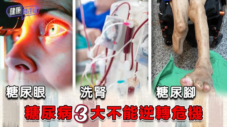 糖尿病3大不能逆轉危機 ｜ 健康關注組 ｜ EP529 ｜ 糖尿病 ｜ 腎衰竭 ｜ 洗腎 ｜ 糖尿眼 ｜ 糖尿腳 ｜ 截肢 ｜ 敖嘉年 ｜ 朱智賢 ｜ HOY TV 77台