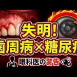 【衝撃】歯医者で「隠れ糖尿病」発覚！？失明リスクも…3人に1人が陥る歯周病と高血糖の罠