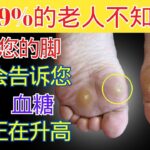 脚部发出的9个糖尿病警示信号