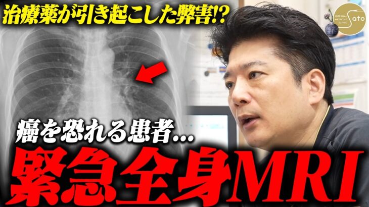『肺がんの危険！？』医師が決断！緊急、全身MRI検査敢行！糖尿病治療薬が患者を苦しめる！？