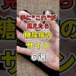 手に「コレ」が見えたら糖尿病のサイン６選！　#あなたの健康を守るライフハック　 #健康 #雑学  #医療 #糖尿病   #shorts