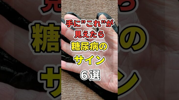 手に「コレ」が見えたら糖尿病のサイン６選！　#あなたの健康を守るライフハック　 #健康 #雑学  #医療 #糖尿病   #shorts