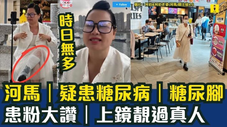 河馬何伯｜時日無多｜疑患糖尿病｜糖尿腳｜患粉大讚｜上鏡靚過真人 #東張西望  #tvb