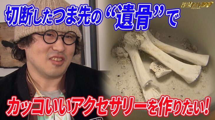 糖尿病でつま先を切断、火葬…俺の”遺骨”でカッコいいアクセサリーを作りたい！