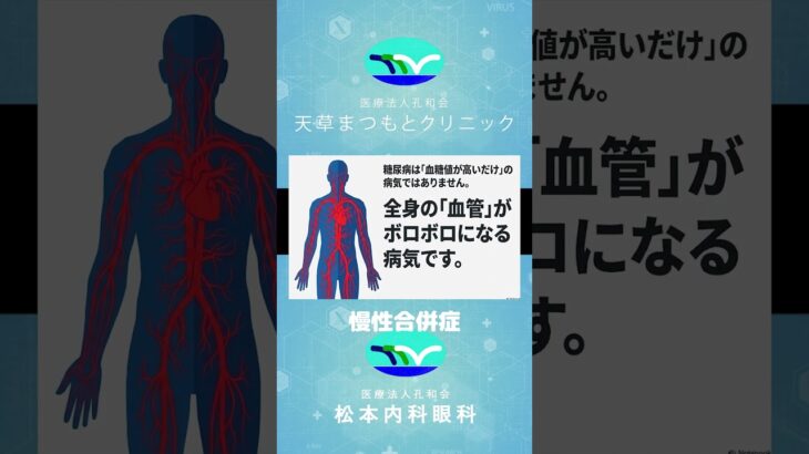糖尿病「慢性合併症」の本当に怖い話！
