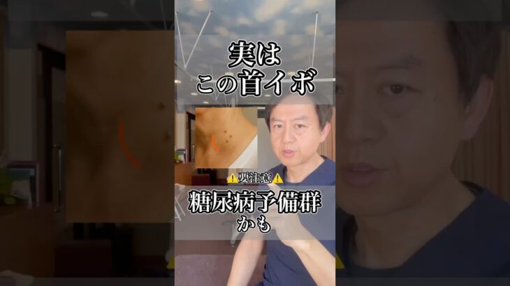 実は首のイボ糖尿病予備軍