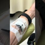 抗がん剤投与日#大腸がん #糖尿病 #心筋炎#うどん食べたい #ラーメン食べたい