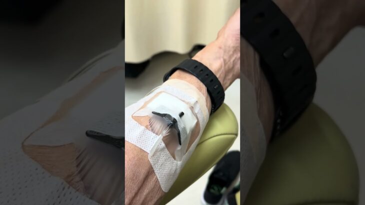 抗がん剤投与日#大腸がん #糖尿病 #心筋炎#うどん食べたい #ラーメン食べたい