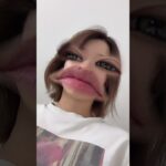 妊娠糖尿病になってしまいました