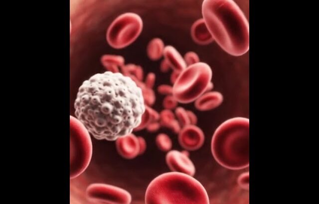 糖尿病ヒストリー　ショート