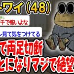 【悲報】糖尿病で両足切断することになりマジで絶望してる。
