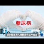 #糖尿病多饮多食，中医教你两味药改善，生津止渴清热泻火！,健康养生,中医药