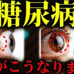 放置厳禁！知らないと後悔する糖尿病の「目」の初期症状。かすみ・ゆがみ・飛蚊症..絶対に見逃してはいけない失明の危険サインとは？自分で気づける目のチェック方法とは？医師が徹底解説！
