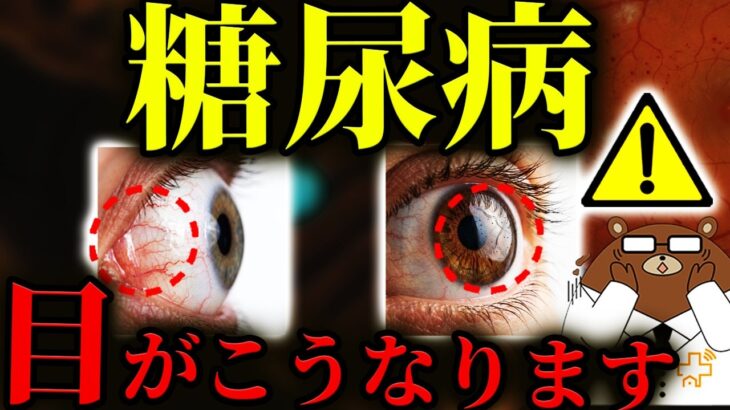 放置厳禁！知らないと後悔する糖尿病の「目」の初期症状。かすみ・ゆがみ・飛蚊症..絶対に見逃してはいけない失明の危険サインとは？自分で気づける目のチェック方法とは？医師が徹底解説！