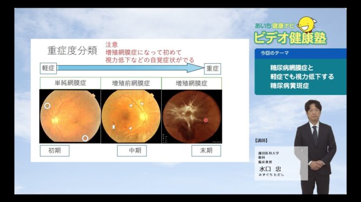 糖尿病網膜症と軽症でも視力低下する糖尿病黄斑症