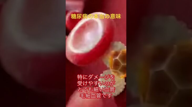 糖尿病の本当の意味　#糖尿病#医療雑学#医学#健康知識#医学生#youtubeshorts #医療