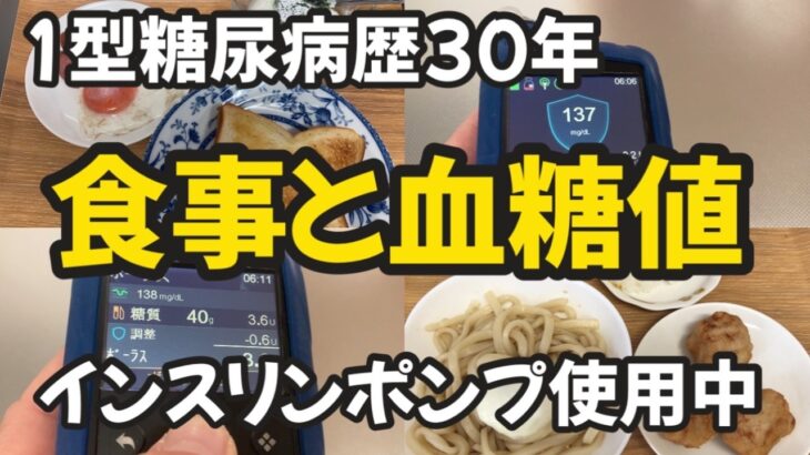 【1型糖尿病】インスリンポンプで血糖コントロール！　リアルな食事・・・野菜不足な日　MiniMedミニメド780G