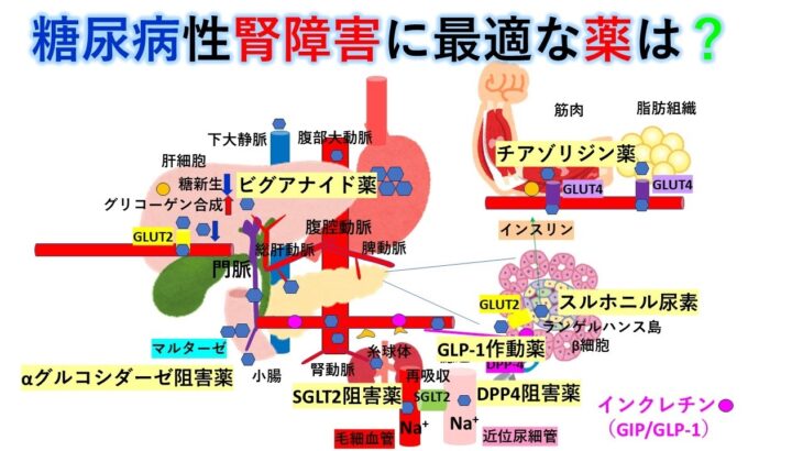 国試対策:暗記から卒業 173話 糖尿病性腎障害の薬物治療