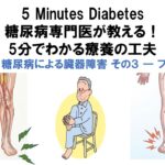 糖尿病専門医が教える！5分でわかる療養の工夫　第８回　糖尿病による臓器障害 その３ ― フットケア