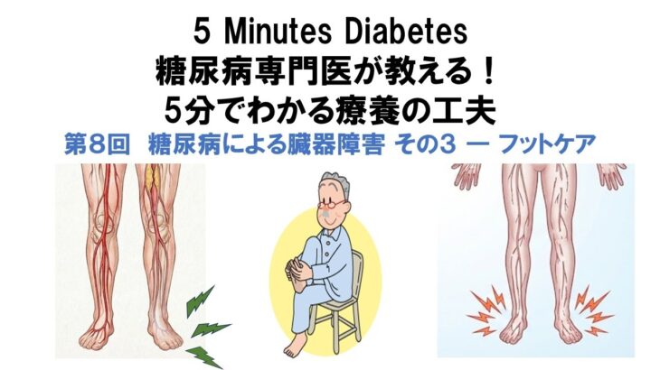 糖尿病専門医が教える！5分でわかる療養の工夫　第８回　糖尿病による臓器障害 その３ ― フットケア