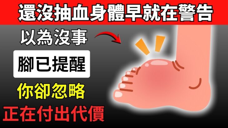 很多人以為糖尿病要抽血才知道，其實腳早就發出9個求救訊號，只是你一直忽略