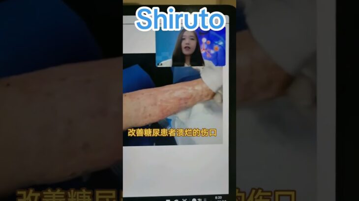 糖尿病患者已經要截肢了但BE產品幫助了他