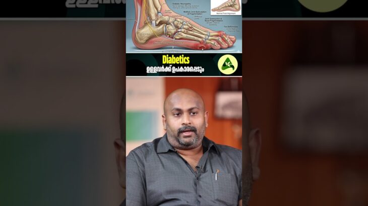 Diabetics ഉള്ളവർക്ക് ഉപകാരപ്പെടും #Diabetes #FootCare #DrKoshyPanicker