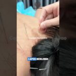 GULA DARAH SULIT TURUN? ⚠️🩸