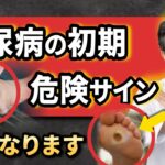 【放置厳禁】 😱 絶対に放置してはいけない糖尿病『足』の警告 【注意な合併症】 🚨糖尿病が隠した恐ろしいSOSサイン