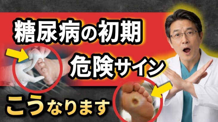 【放置厳禁】 😱 絶対に放置してはいけない糖尿病『足』の警告 【注意な合併症】 🚨糖尿病が隠した恐ろしいSOSサイン