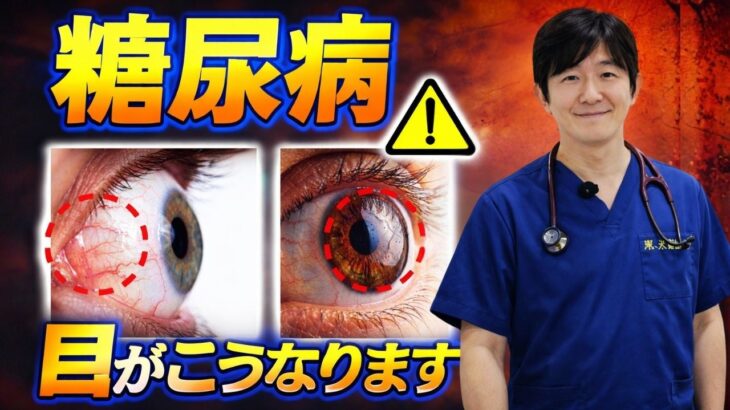 放置厳禁！知らないと後悔する糖尿病の「目」の初期症状。かすみ・ゆがみ・飛蚊症..絶対に見逃してはいけない失明の危険サインとは？自分で気づける目のチェック方法とは？医師が徹底解説！| 高齢者健康
