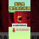 不是小問題！慢性發炎正在悄悄引發心臟病、糖尿病，甚至癌症【高年級實習生來了】