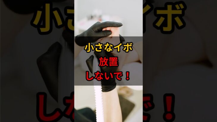 首周りの小さなイボは「糖尿病」の予備軍サイン #健康