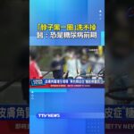 「脖子黑一圈」洗不掉 醫：恐是糖尿病前期 #糖尿病 #黑色棘皮症