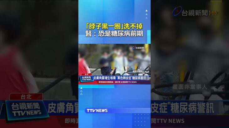 「脖子黑一圈」洗不掉 醫：恐是糖尿病前期 #糖尿病 #黑色棘皮症