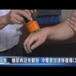 《大大寬頻》糖尿病足免截肢 冷電漿加速修復傷口