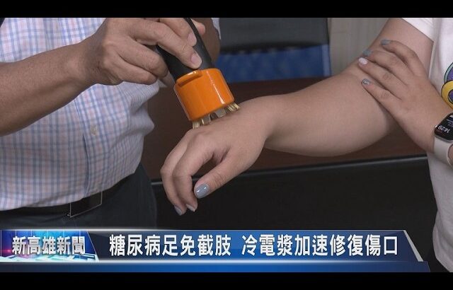 《大大寬頻》糖尿病足免截肢 冷電漿加速修復傷口