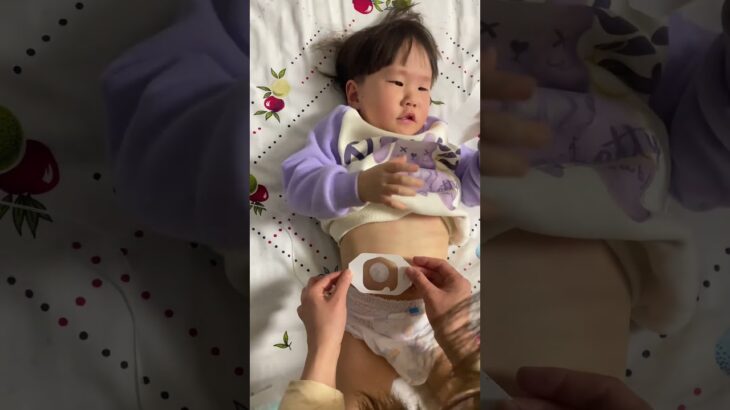 今天给崽崽换个管路#糖尿病 #控糖饮食 #抗糖生活 #糖友 #血糖