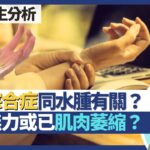 腕管綜合症｜與水腫有關 糖尿病、甲減易患腕管綜合症！手指麻痹點分係頸椎問題或腕管問題？手指無力或已肌肉萎縮？｜王建芳醫生 骨科醫生區卓嬈醫生｜人類健康研究所