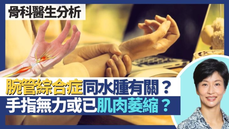 腕管綜合症｜與水腫有關 糖尿病、甲減易患腕管綜合症！手指麻痹點分係頸椎問題或腕管問題？手指無力或已肌肉萎縮？｜王建芳醫生 骨科醫生區卓嬈醫生｜人類健康研究所