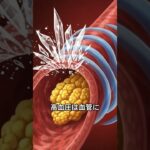 【医師解説】糖尿病・高血圧・脂質異常症の“トリプルリスク”とは？放置で動脈硬化が急加速！