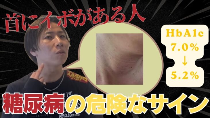 クビにイボは危険なサイン。血糖値がガチで下がるツボ