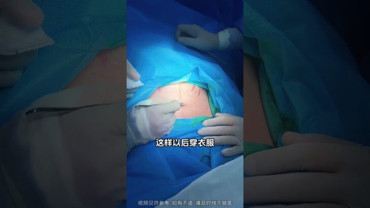 23岁小姑娘妊娠期糖尿病，没有羊水了，选择剖腹产#孕期 #顺产 #糖尿病 #分娩 #妇产科郭莉医生