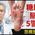 腳上這5個變化，糖尿病患者千萬不能忽視！醫師親眼見過太多人因此截肢，你的腳今天檢查了嗎？